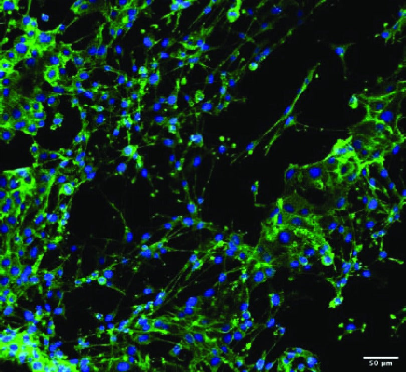 Confocal micrograph of fibroblasts colonising an electrospun scaffold produced on Linari equipment
